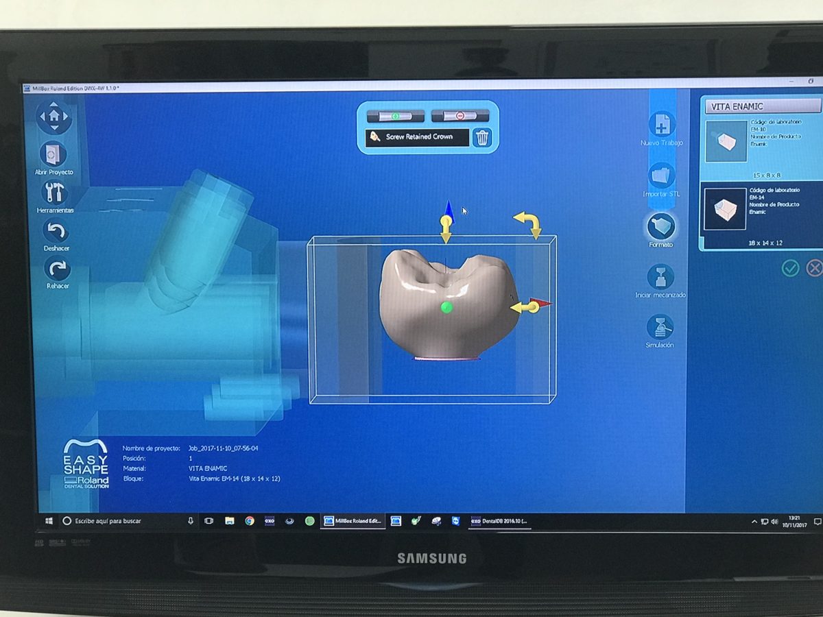 WORKSHOP: flujo de trabajo CAD-CAM, del escaneo intraoral al acabado ...