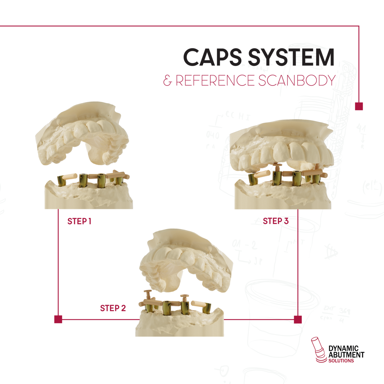 CAPS System Dynamic Abutment Solutions ES