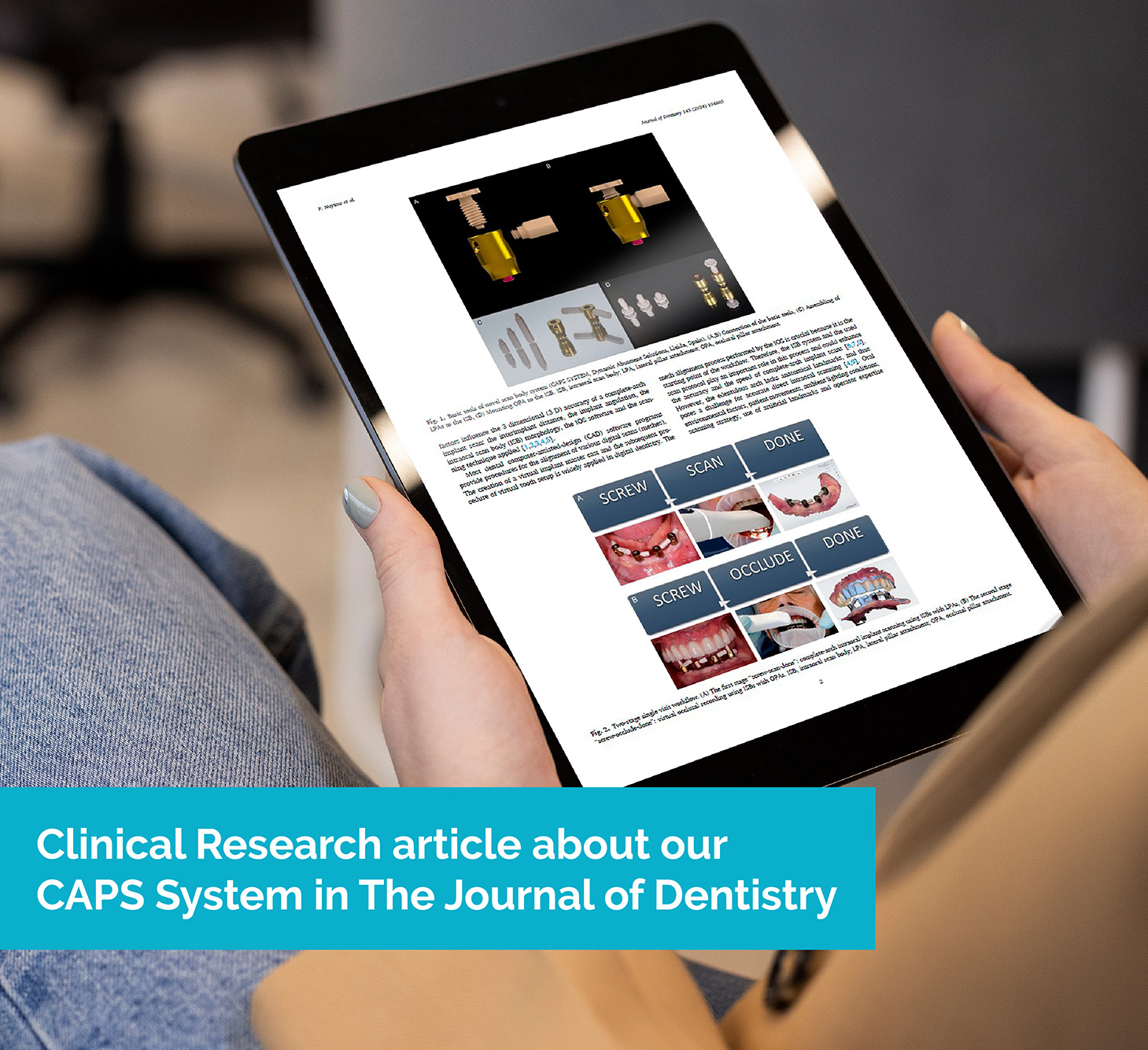 Featured image for “Estudio clínico de nuestro CAPS System en The Journal of Dentistry”